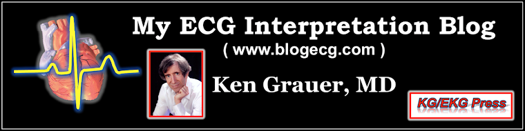 ECG Interpretation